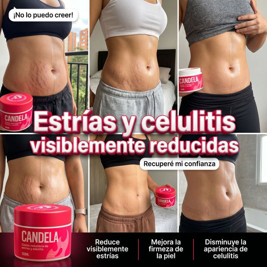 CANDELA™ Crema 300 ML - Piel firme Sin estrías y celulitis 🔥🔥